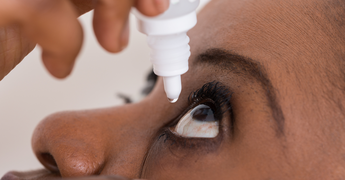 A Síndrome do Olho Seco é uma anomalia na produção das lágrima ou até mesmo na sua qualidade, podendo desencadear o ressecamento, infecção ou inflamação na superfície do olho.