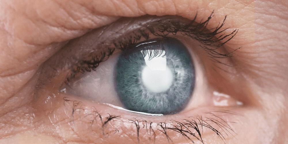 Abril Marrom é um alerta sobre doenças que podem levar à cegueira.